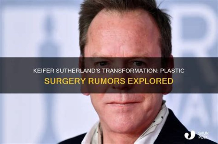 Did Kiefer Sutherland Get Plastic Surgery? Body Measurements and More