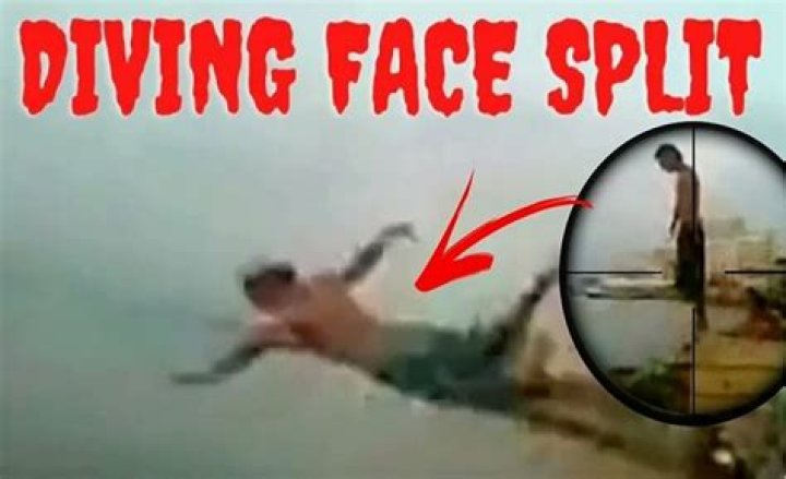 Diving Face Spl1t Video Face Spl1t Diving Incident Explained