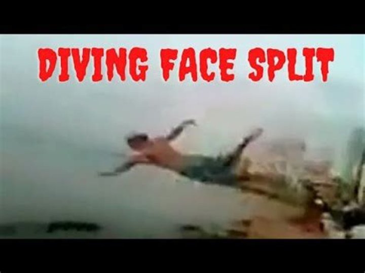 Face Split Diving Accident &raquo; Otaewns