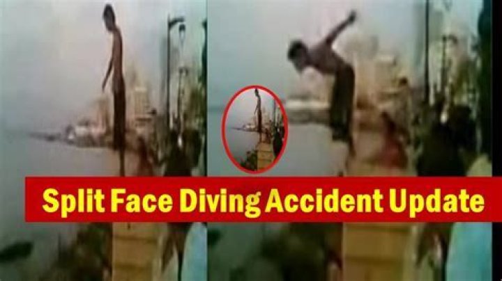 Face Split Diving Incident