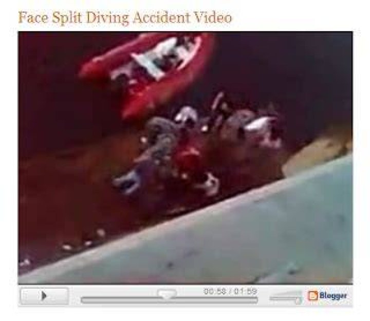 Split Face Diving Accident Video Face Split Diving Accident Video