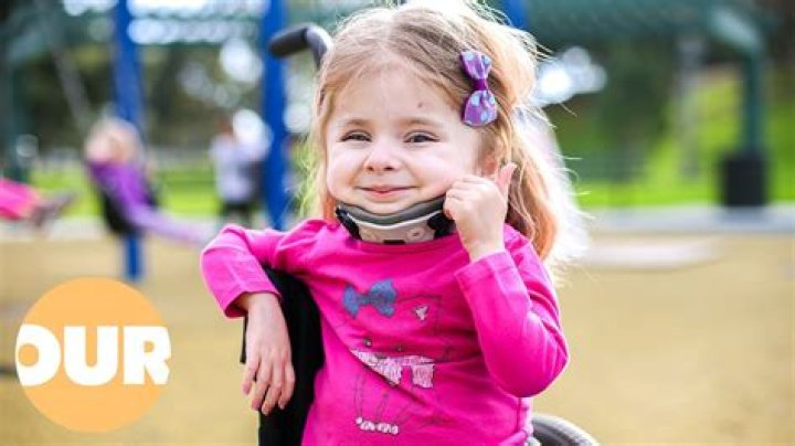 The Girl Whose Bones Break Easily (Born Different) Our Life YouTube