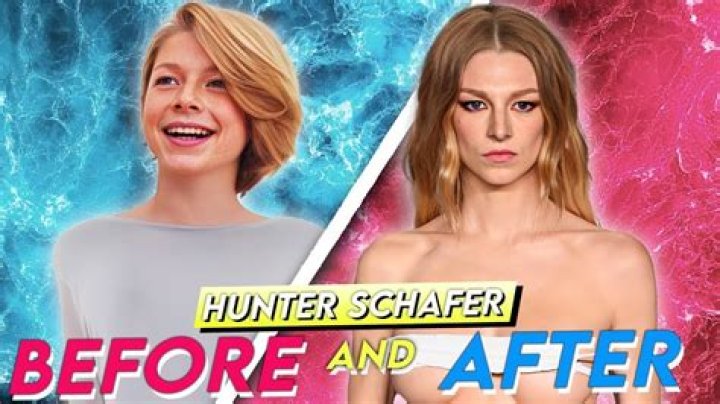 Understanding Hunter Schafer Surgery: A Comprehensive Guide