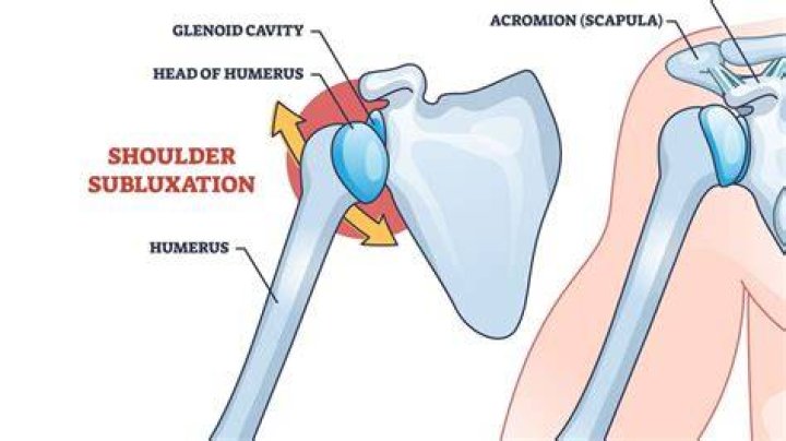 What is a shoulder charge?