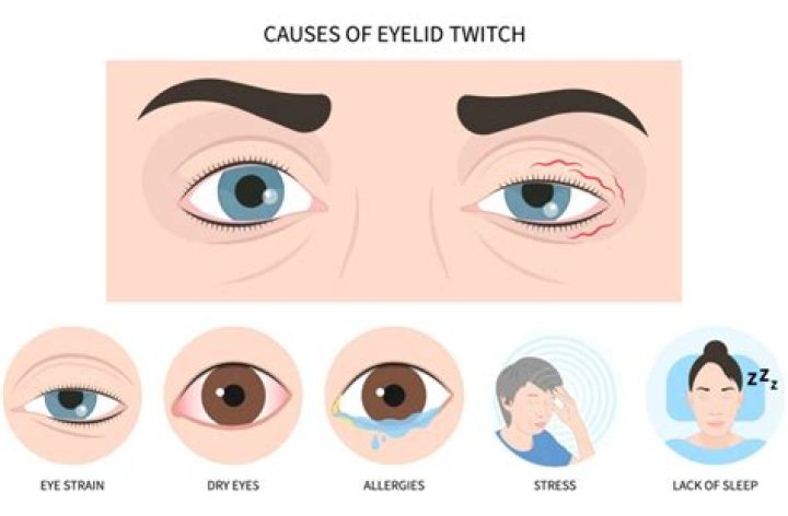 Why does my Twitch keep stuttering?